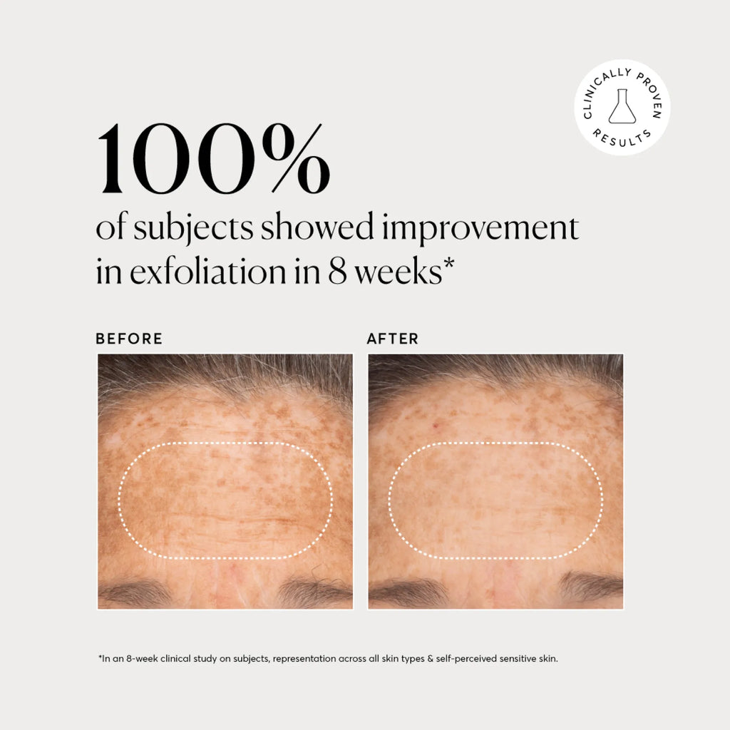 bha-liquid-exfoliant-2-u8 NATR-10027-Alt-Images-BHA-Liquid-Exfoliant-2_-03.webp