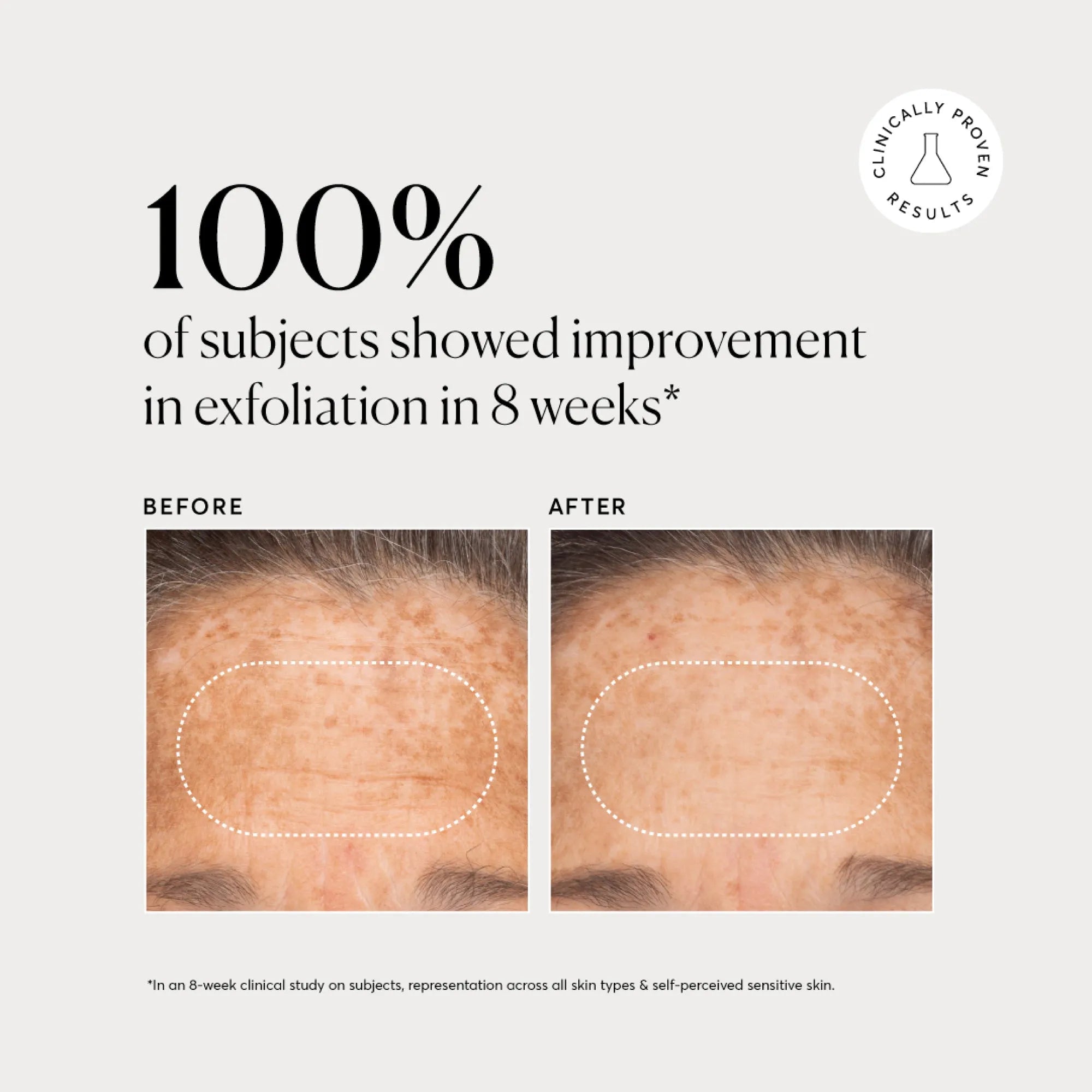 bha-liquid-exfoliant-2-u8 NATR-10027-Alt-Images-BHA-Liquid-Exfoliant-2_-03.webp